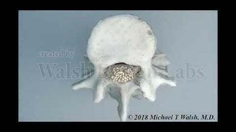 MRI and Spinal Anatomy Review