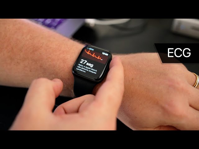 Apple confirma que ECG do Apple Watch será liberado no Brasil com watchOS  6.2.8