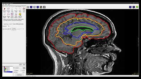 Analyze 14.0 - Segment: Divide Regions Between Borders