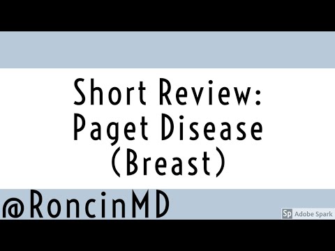 Short Review: Mammary Paget Disease (Breast)