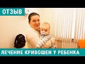 Отзыв о лечении кривошеи у ребенка с помощью тракционного воротника