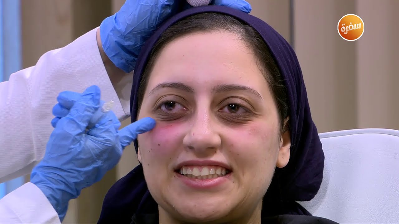 نتيجة مدهشة لحقن الخلايا الجذعية في شد الوجه وعلاج الهالات السوداء | هي وبس