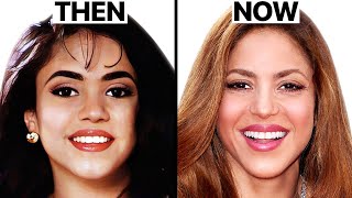 Shakira's NEW FACE | Plastic Surgery Analysis