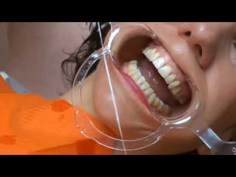 Vidéo: Comment Broder Du Fil Dentaire