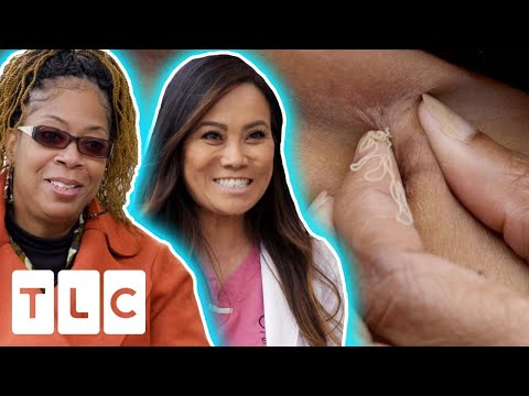 Woman Gets Bump Under Her Breast Removed FOR THE THIRD TIME | Dr. Pimple Popper