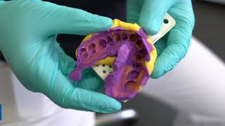 Kettenbach Panasil Putty Soft & X-Light screenshot 3