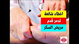 اخطاء وعادات شائعة يفعلها مريض السكر يوميا .... تدمر قدمة تماما