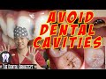 10 Tips to Avoid Dental Caries/Cavities #46 English