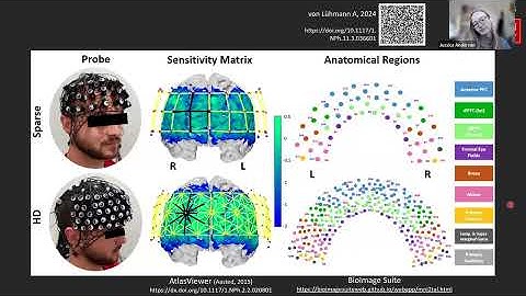 When High-Density fNIRS Matters: Comparing Sparse and HD Arrays Across Stroop Task Conditions