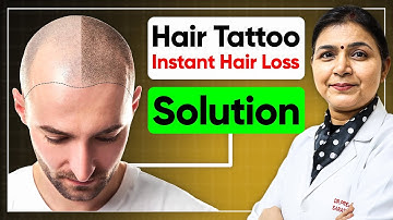Hair Tattoo for Men and Women in Hair Loss - Scalp Micropigmentation #SMP