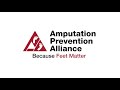 Innovation In Diabetic Foot Ulcer Prevention And Treatment Innovation In Diabetic Foot Ulcer Prevention And Treatment