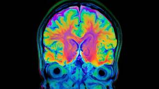 DOPAMINE DOPAMINE DOPAMINE