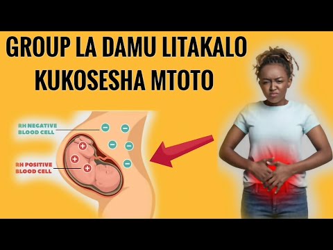 Video: Ni Shinikizo Gani La Damu Ambalo Mtoto Anapaswa Kuwa Nalo