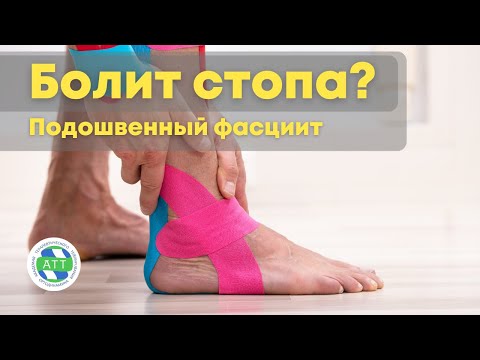 Боль в стопе. Подошвенный фасциит. Тейпирование стопы