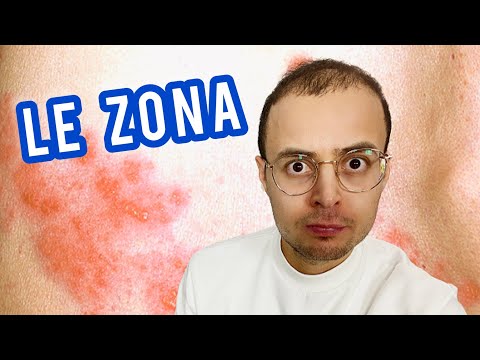 Vidéo: Comment traiter la douleur nerveuse causée par le zona (avec photos)