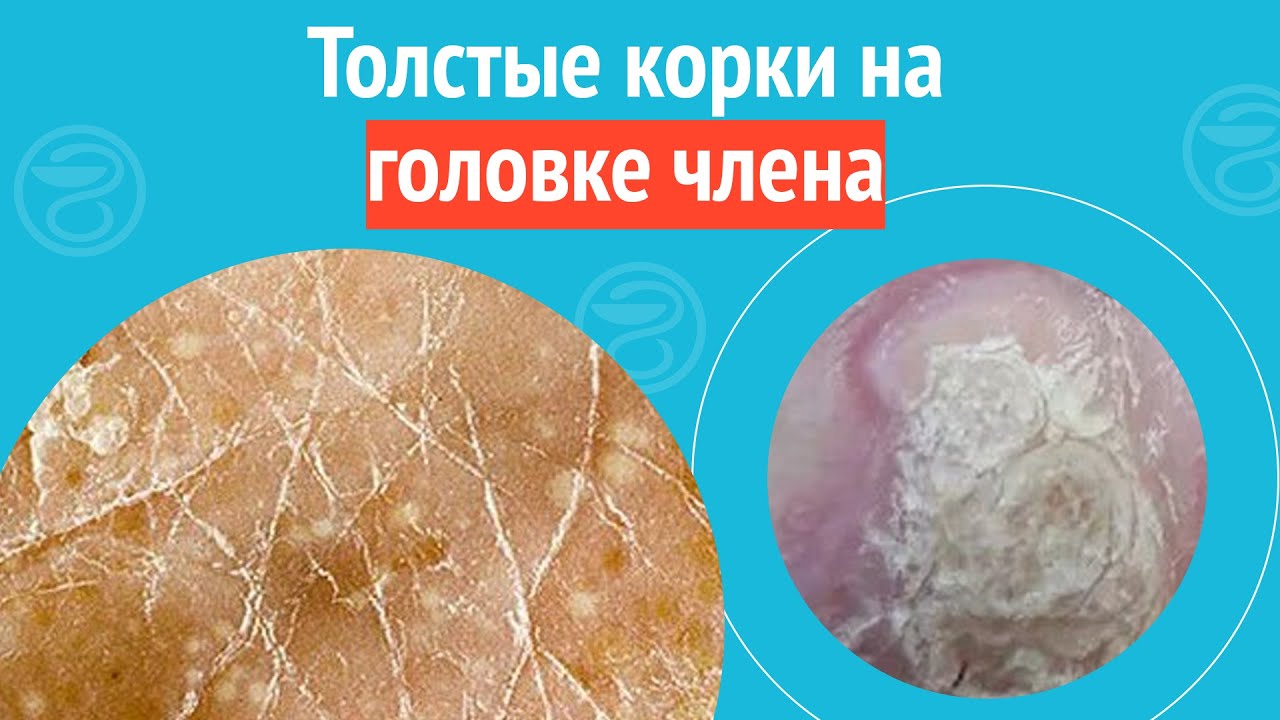 Стекающая смазка с красной головки хера фото