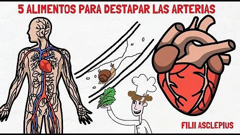 ¿Qué alimentos pueden ayudar a destapar las arterias?