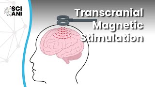 What is Transcranial Magnetic Stimulation and how can it help me?
