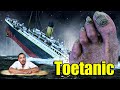 Titanic Toenail- Debriding A Thick Fungal Nail With A Special Surprise