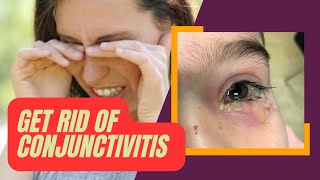 Eye Flu 🤧: Cause, Prevention, Home remedies for CONJUNCTIVITIS | Eye Health care