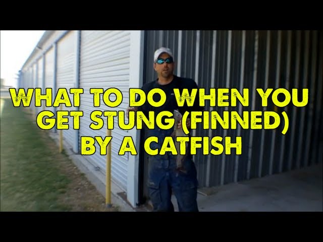 What To Do When You Get Stung (Finned) By A Catfish 