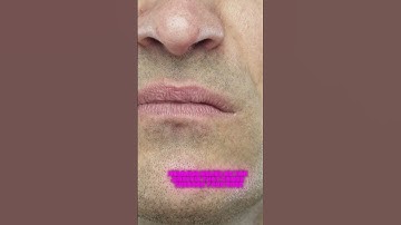 Did you know that it’s impossible to hum while holding your nose?  #facts #shorts #fyp #history