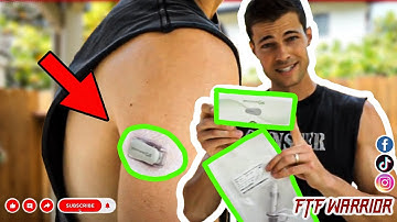 DEXCOM G5: Arm Sensor Change!