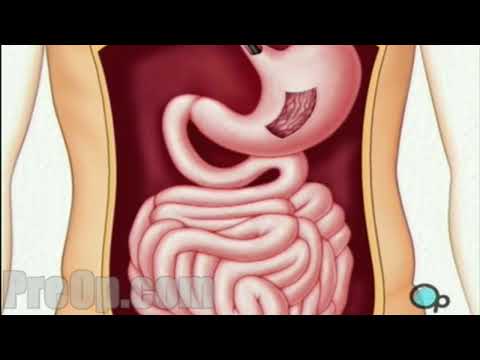 What is an endoscopy like?. 