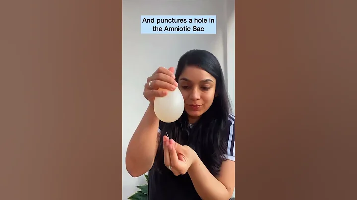 What is Breaking the Water or Amniotomy ? #birthprep #laboranddelivery #shots #pregnancy