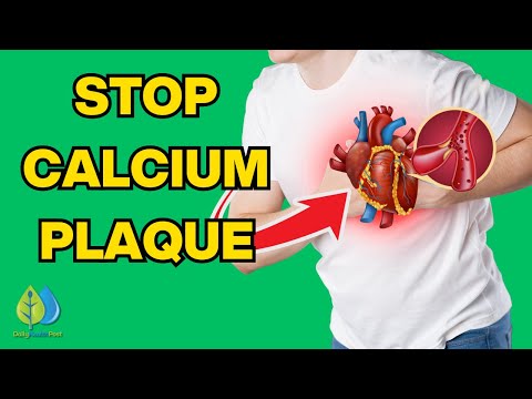 8 Ways To Stop Calcium Plaque In Your Heart Arteries