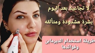 طريقة أستخدام الديرمابن خطوة بخطوة/ فوائدها ونصائح أثناء وبعد الجلسة/Maha Beauty