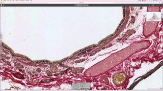Histology of the lung