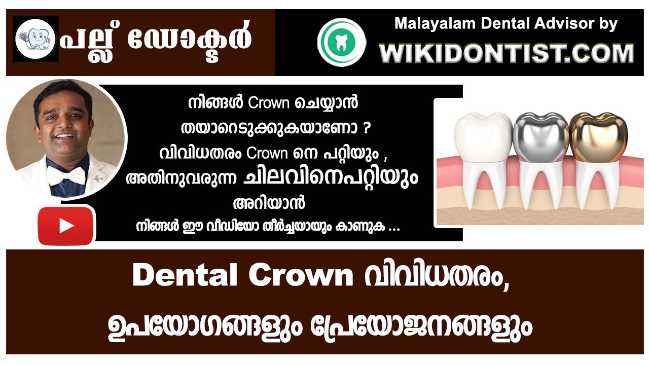 Dental Crown വിവിധതരം പ്രയോജനങ്ങളും / Malayalam Dental Videos/Modern