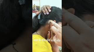 कान कि पीछे होने वाली इस तरह की गाँठ को छोटा सा चिरा लगाकर निकाला जाता है ।