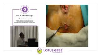 Prof. Dr. A.Akın Sivaslıoğlu-Pelvik Organların Fonksiyonel ve Klinik Anatomisi