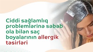 Saç Boyası Allergiyası Nədir? Allergiya Nəfəs Darlığına Səbəb Olurmu?