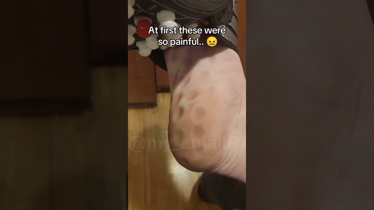 Acupressure slipper for body pain, blood circulation, acupressure points ￼