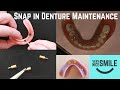 What goes wrong with snap in dentures.