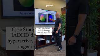 Case Study of ADHD #mentalhealthshorts #shorts #shortsmentalhealth