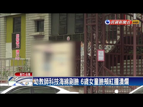 幼教師科技海綿刷臉 6歲女童臉頰紅腫潰爛－民視新聞