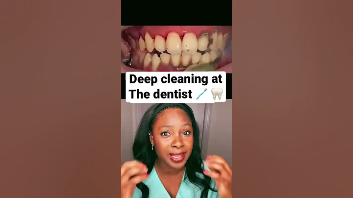 Deep cleaning at the dentist #shorts #teethcleaning