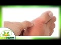 como bajar el acido urico de manera natural - como combatir el acido urico de manera natural