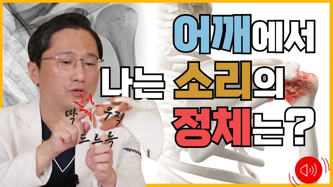 어깨에서 뚝! 딱!드르륵! 덜컹! 그외 다양한 소리가 신경쓰이나요! 그 중 00한 소리는 위험신호 입니다!!