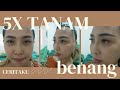 PENGALAMAN FILLER TANAM BENANG HIDUNG , AUTO MANCUNG