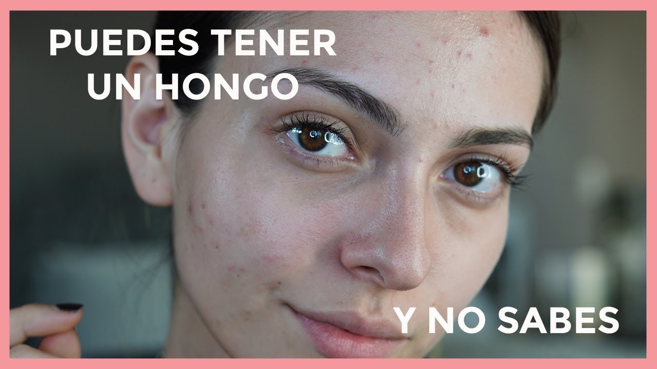 Granos transparentes en la cara