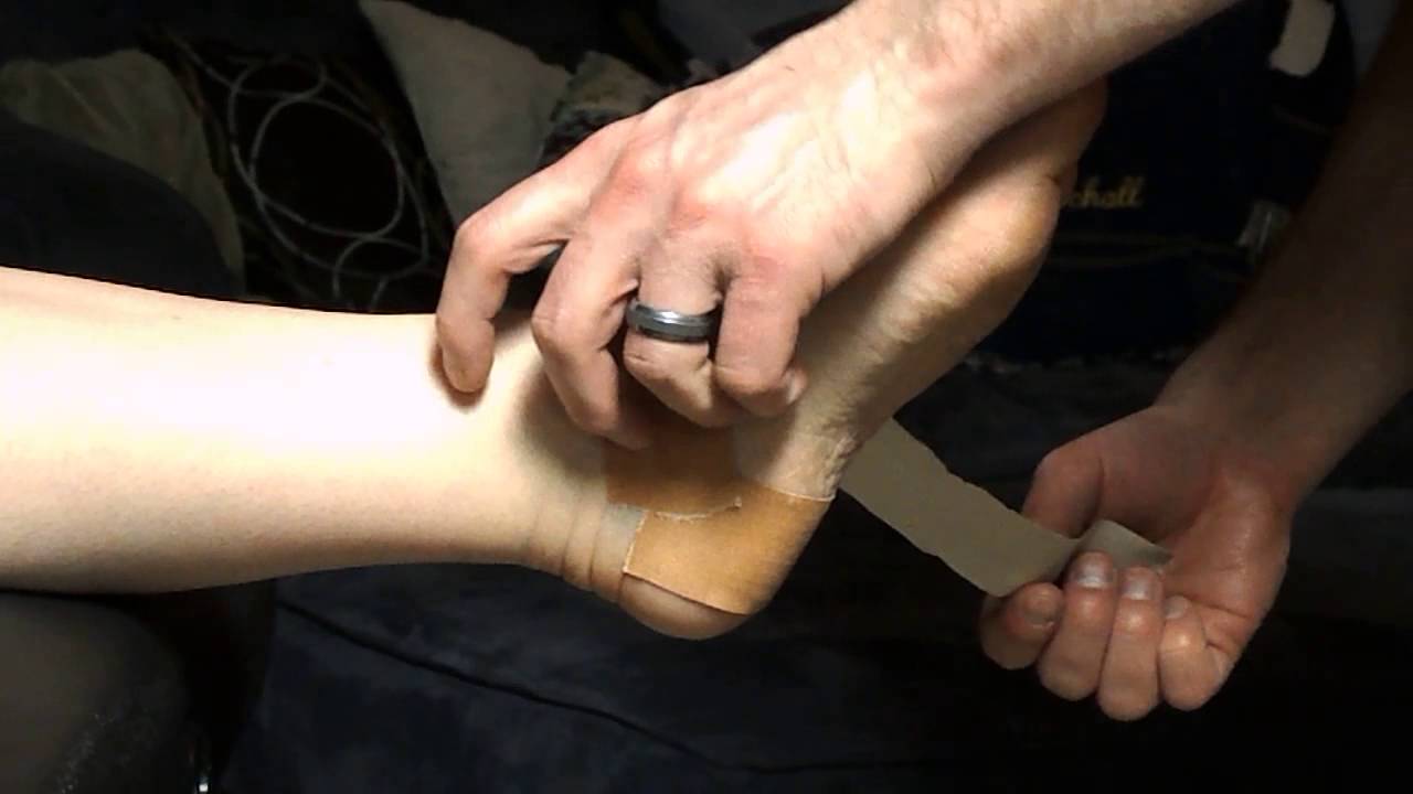 Calcaneal eversion youtube