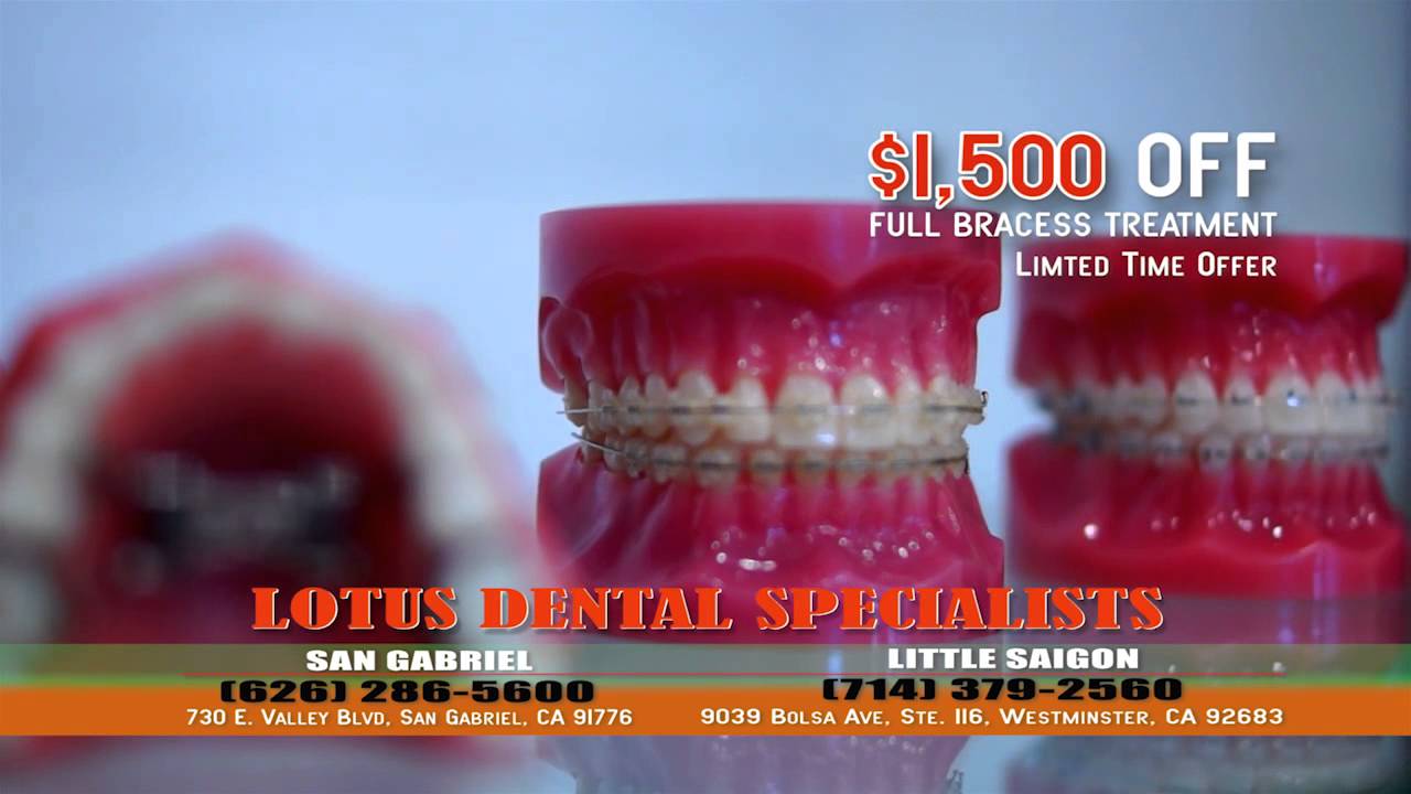 Lotus DentaL Specialists YouTube