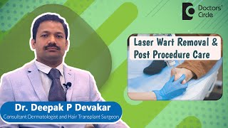 Warts Removal With Laser Treatment- What to expect #skin  -Dr. Deepak P Devakar| Doctors' Circle screenshot 2