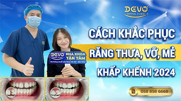 Cách khắc phục răng thưa, răng vỡ, sứt mẻ, khấp khểnh 2024?