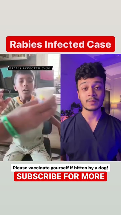 He was bitten by a dog twice😨Rabies Infected Case| Raj Bhosle #shorts #medical #viral